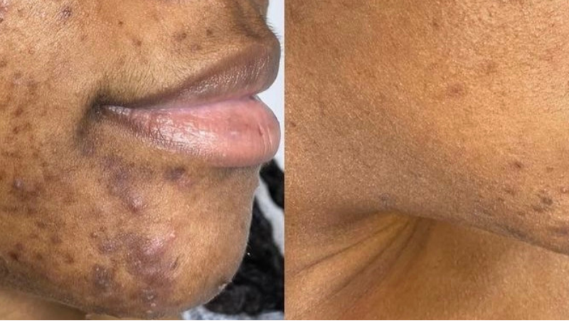 Melanin Magic Oil
