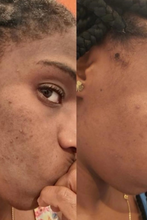 Load image into Gallery viewer, Turmeric &amp; Kojic Brightening Pads
