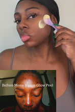 Load and play video in Gallery viewer, Melanin Magic Peel (Severe Darks Spots &amp; Acne)
