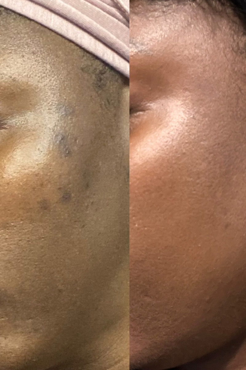 Complexion Glow Renewal System (5 pc)