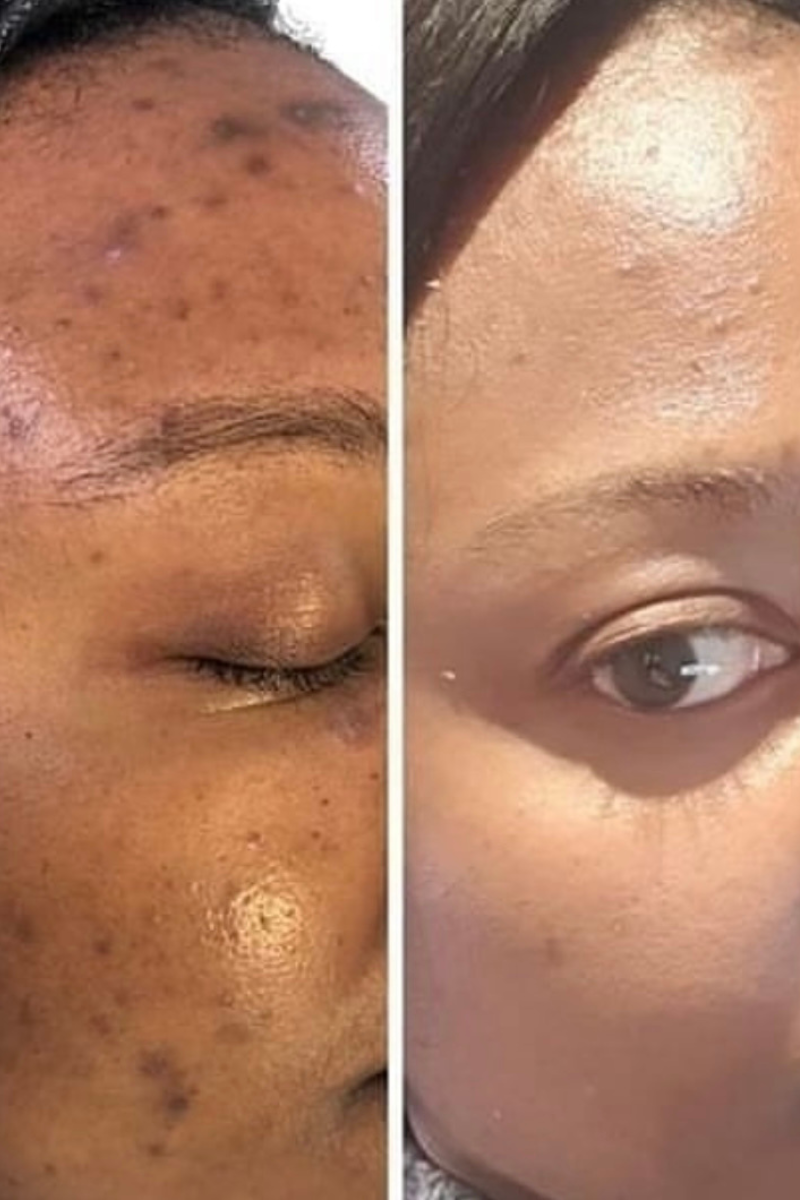 Complexion Glow Renewal System (5 pc)