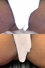 Load image into Gallery viewer, Melanin Magic Peel ( for Hyperpigmentation &amp; Acne)
